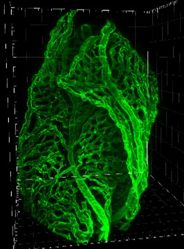 plexus choroides