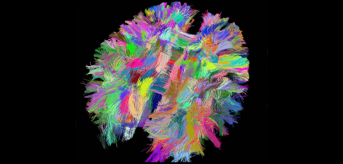 Image cerveau couleurs crédits photos CNRS Photothèque / Université de Strasbourg / Antoine Grigis