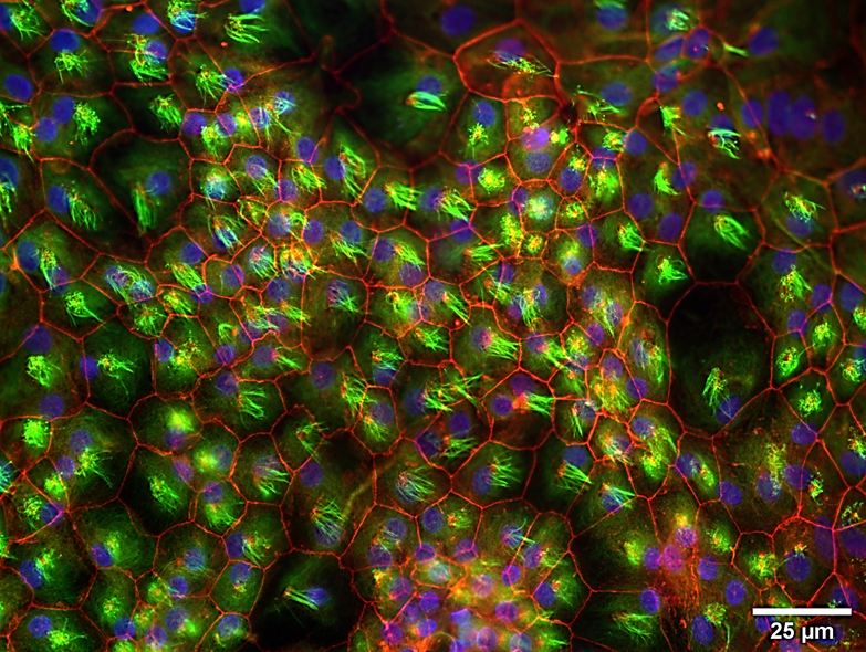 Cellules épendymaires en culture donc les cils sont marquées en vert et les membranes marquées en rouge.
