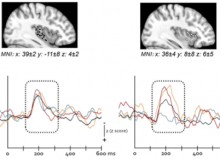 Overlay of all the mean local field evoked potentials recorded after presentation of neutral and emotional faces in the posterior and anterior insula