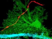 red axon, green astrocyte, blue blood vessel