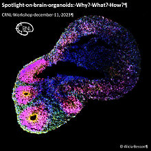 Cerebral organoid